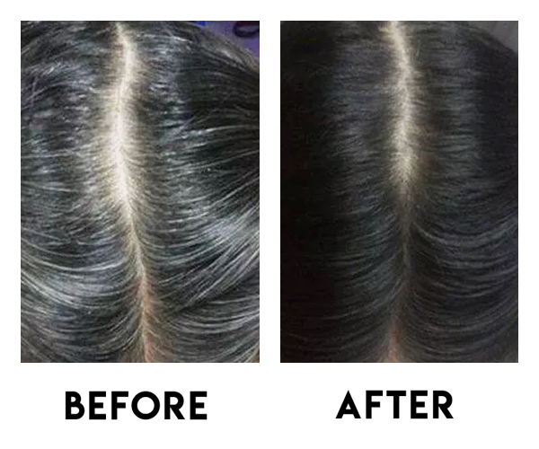 No.1 Hair Regrowth Treatment | Try One Session for $28